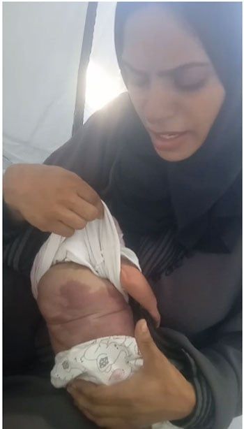 والدة الطفلة حبيبة أبورضوان والدة الطفلة حبيبة أبورضوان