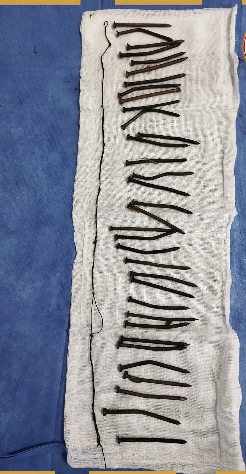 المسامير المستخرجة من معدة مريضة