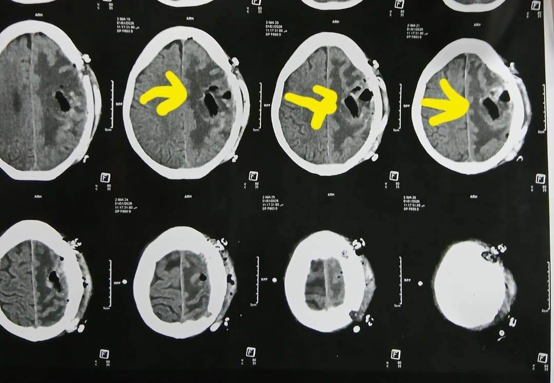 أشعة المريضة أشعة المريضة