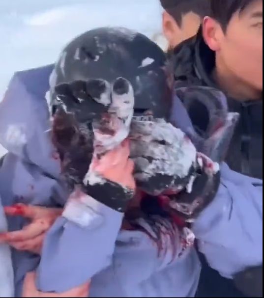 اصابة السائح اصابة السائح