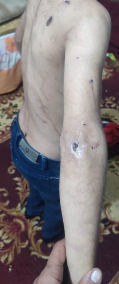 1000346280 1000346280