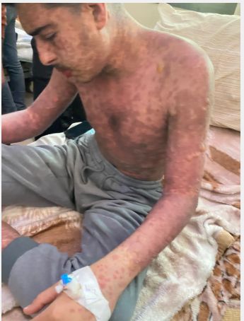 محمد ضبان محمد ضبان