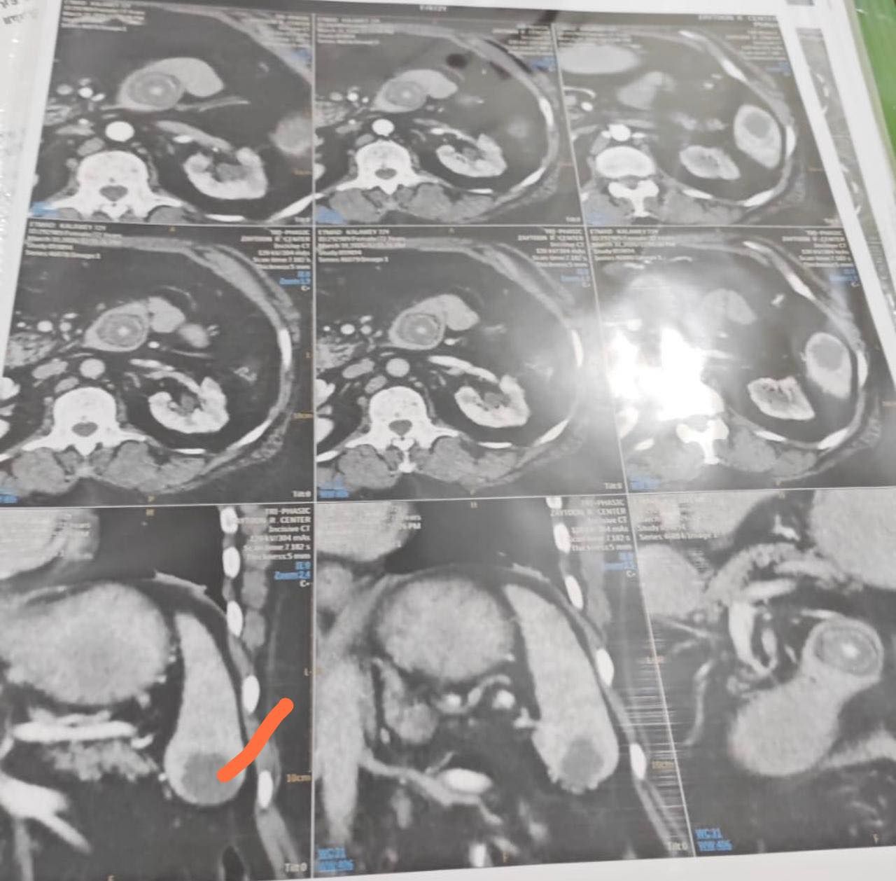 الاشعات الخاصة بالسيدة المسنة الاشعات الخاصة بالسيدة المسنة