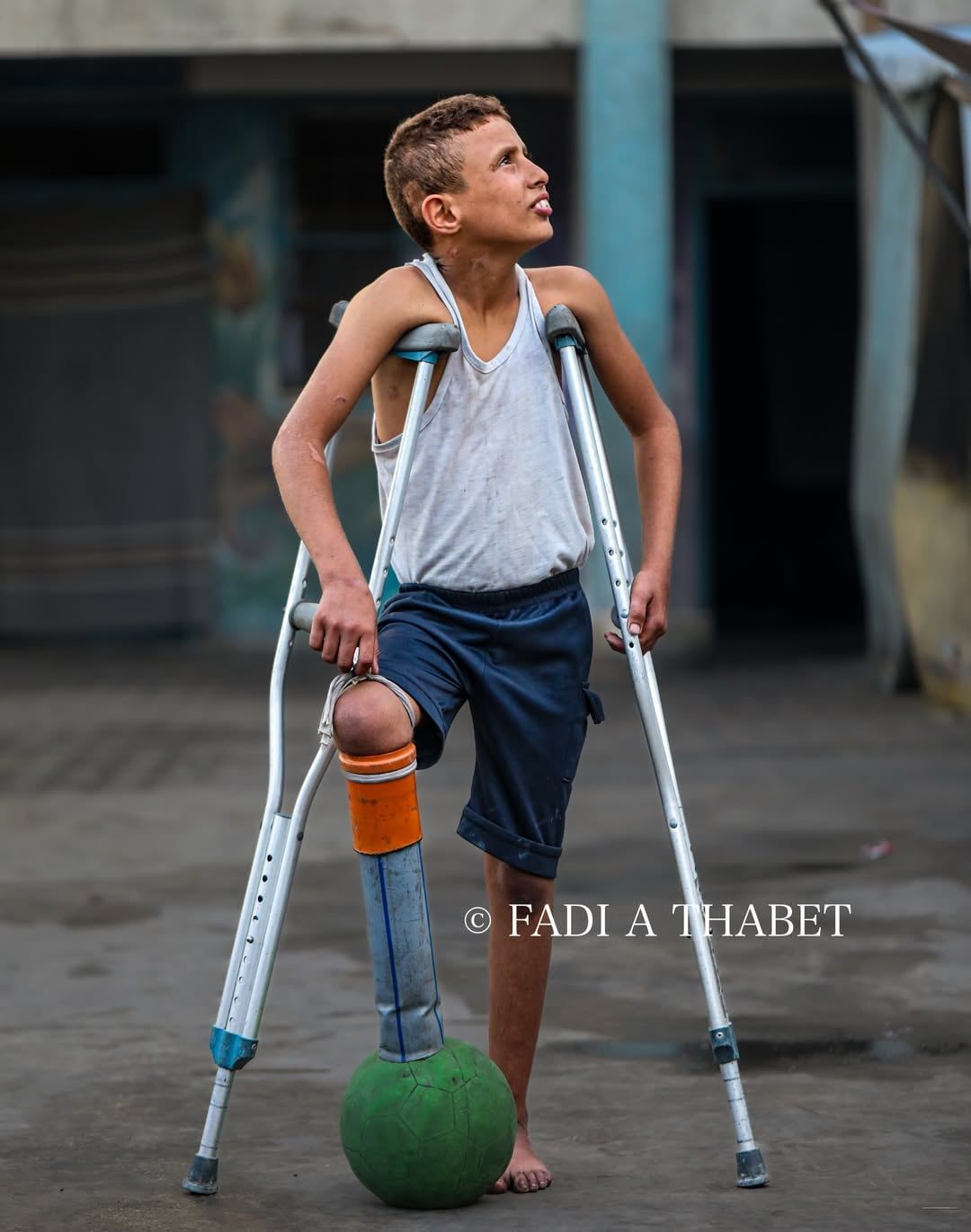 الإصابة لم تمنعه من اللعب الإصابة لم تمنعه من اللعب