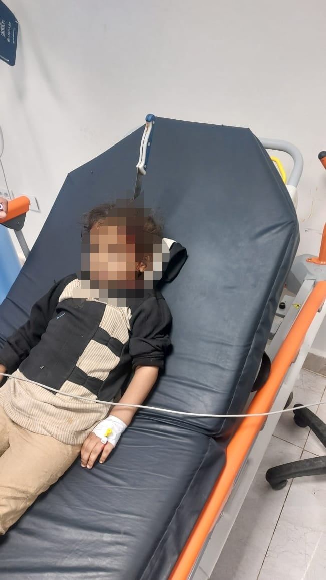 الطفلة قبل الجراحة الطفلة قبل الجراحة