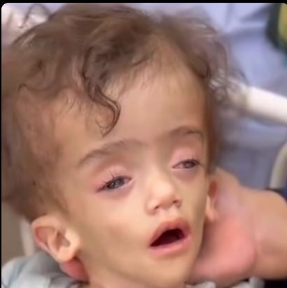 الرضيع عصام النبيه الرضيع عصام النبيه