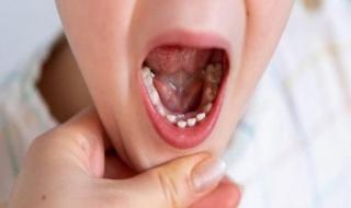 بالبلدي : ما يجب فعله مع الطفل عند زيارته لطبيب الأسنان