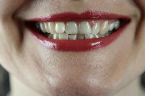 خبيرة تكشف عن طريقة مثلى لمواجهة تسوس الأسنان وإبقاء الفم في حالة صحية
