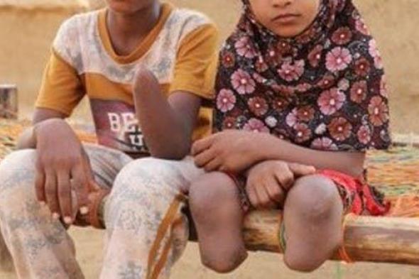 مرصد حقوقي: 78 شخصاً ضحايا ألغام الحوثي بشبوة ومأرب بأسبوعين  