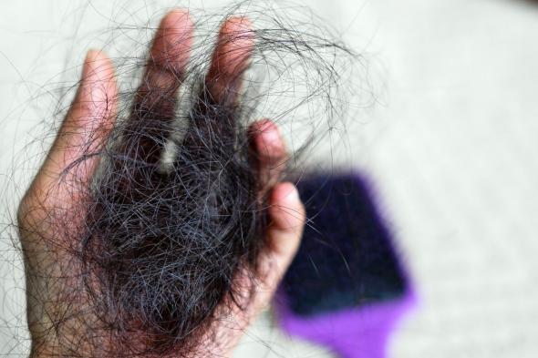 ماذا تقول أحدث الأبحاث عن تساقط الشعر وطرق إعادة نموه؟