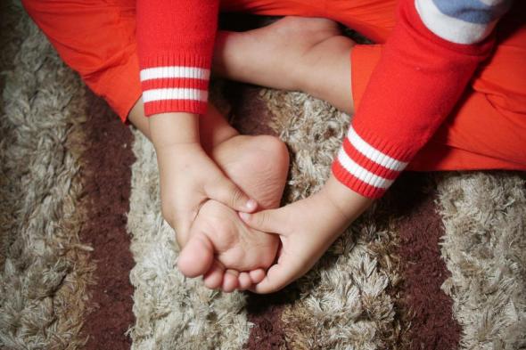 7 أسباب لرائحة القدم الكريهة لدى الأطفال