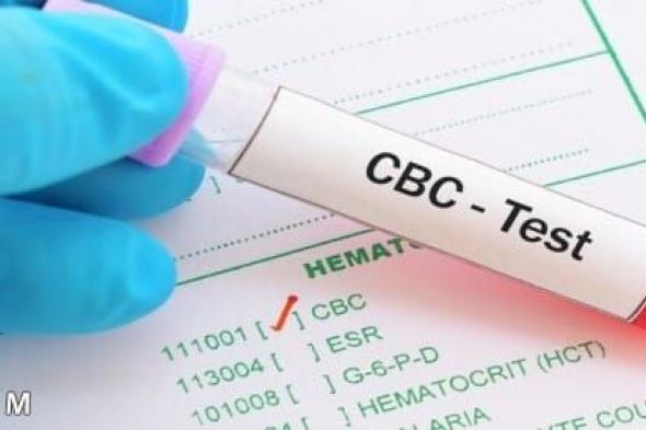 هل تحليل cbc يكشف سرطان الغدد اللمفاوية