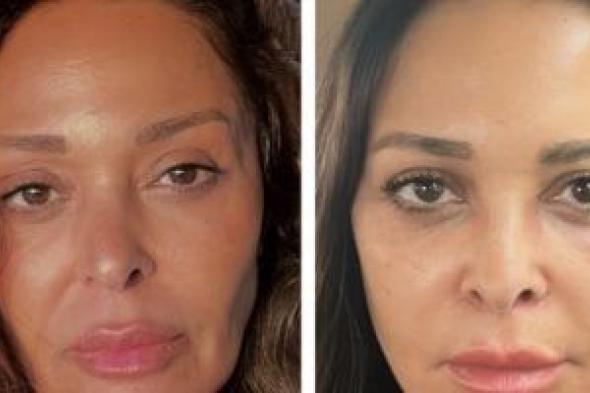 داليا
البحيرى
بعد
عمليتها
الأخيرة:
ممتنة
جدا
لكل
كلمة
طبطبة
وكل
دعم