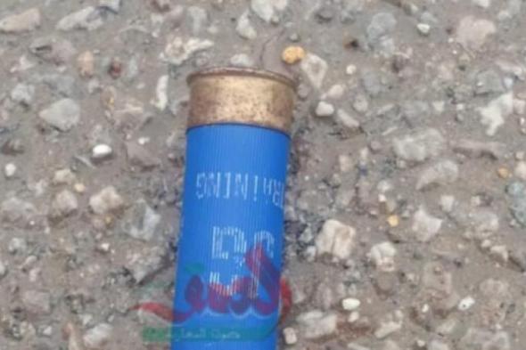 بالبلدي
      :
      استنفار
      أمني
      ضواحي
      طنجة
      بعد
      إطلاق
      نار
      في
      خلاف
      يشتبه
      ارتباطه
      بتهريب
      المخدرات
      (صورة)