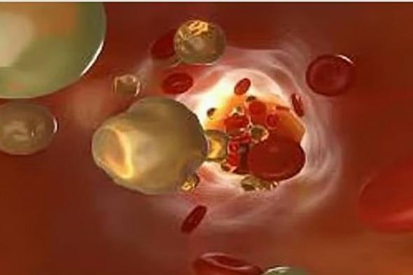 استشاري:
    ضعف
    الغدة
    الدرقية
    يؤدي
    إلى
    ارتفاع
    الكوليسترول