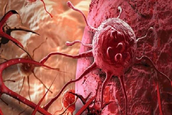 علماء
    روس
    يبتكرون
    تقنية
    حديثة
    لتدمير
    الخلايا
    السرطانية