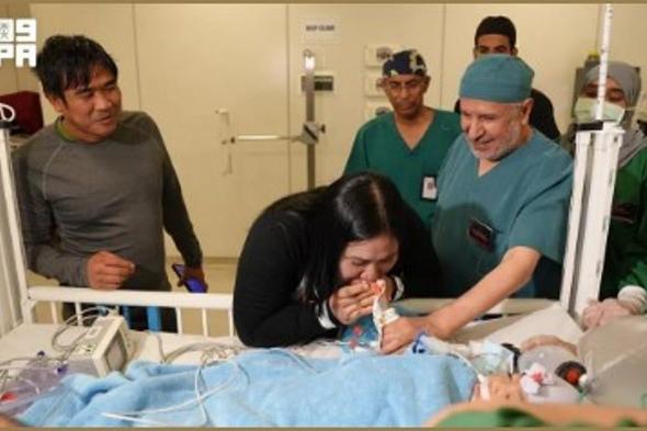 في
    إنجاز
    طبي
    جديد..
    نجاح
    عملية
    فصل
    التوأم
    الملتصق
    الفلبيني
    بعد
    6
    ساعات