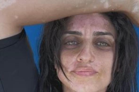 القصة
الكاملة
لدعم
أمير
كرارة
لشقيقته
بعد
إصابتها
بالبهاق:
هو
انتي
فيه
في
حلاوتك