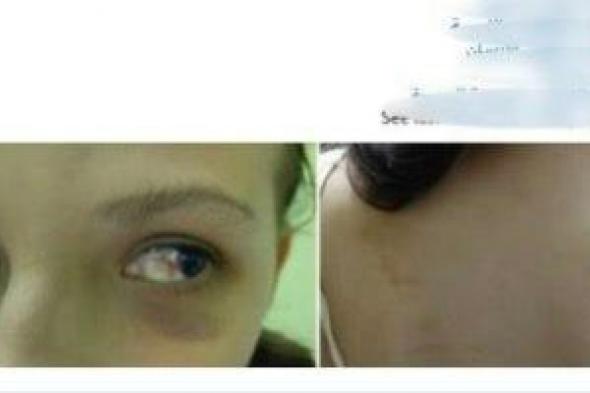سيدة
تتهم
طليقها
بالانتقام
منها
لزواجها
من
آخر
بضرب
ابنتهما