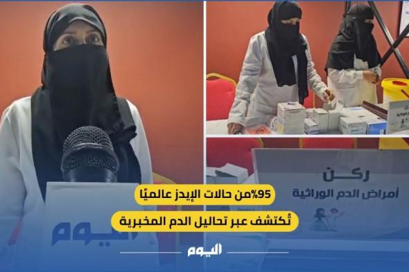 95 % من حالات الإيدز عالمياً تُكتشف عبر تحاليل الدم المخبرية