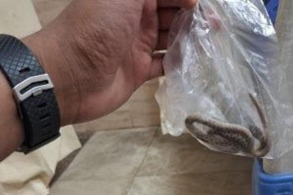 مواطن قناوي يصطحب ثعبانا لدغه للمستشفى داخل كيس لتحديد العلاج المناسب